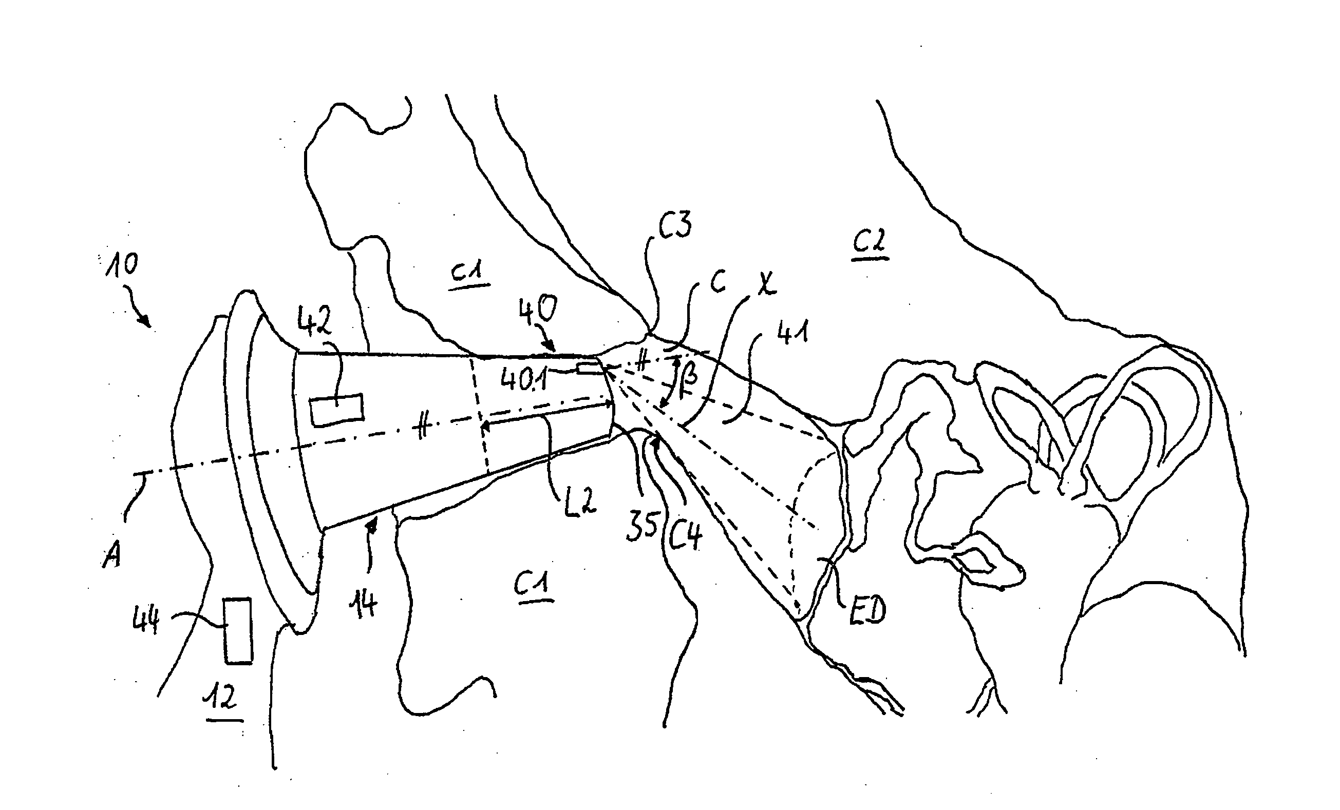 Otoscope and otoscopic method based on spectral analysis