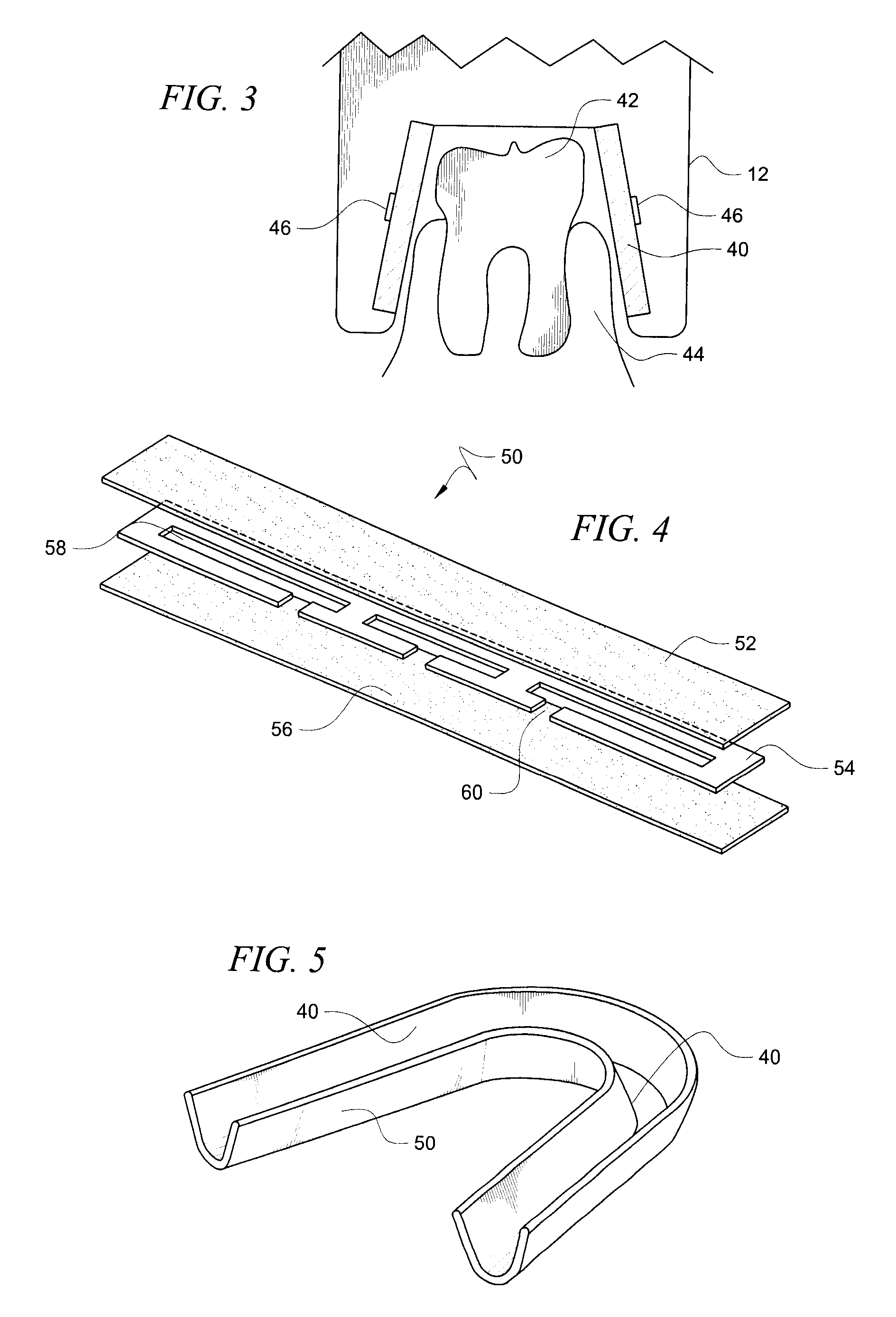 Treatment device and method for treating or preventing periodontal disease through application of heat