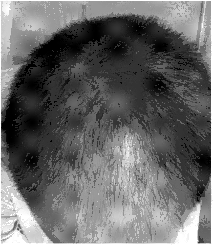 Traditional Chinese medicinal anti-hair loss and hair growth liquid composition for men