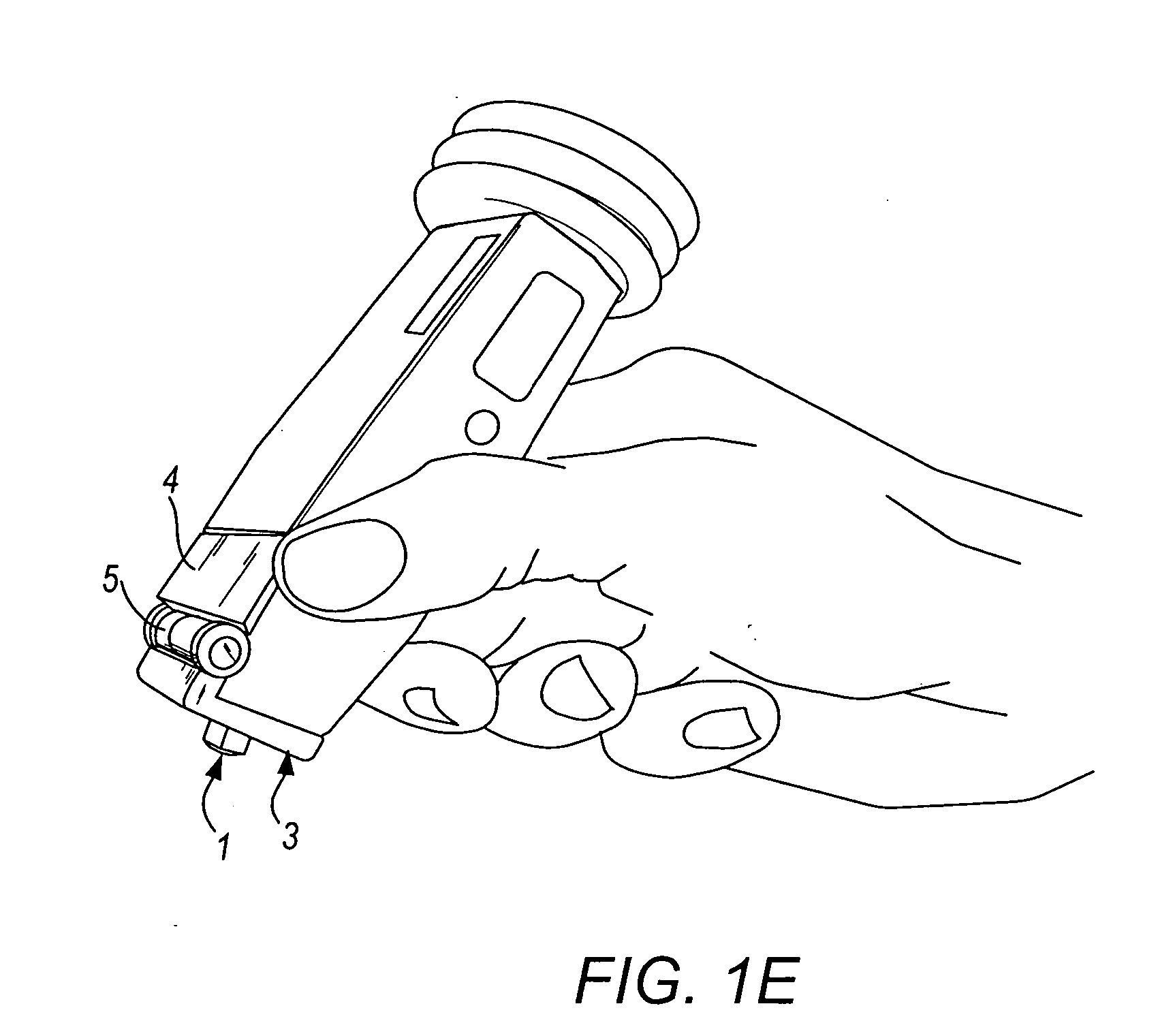 Method and device for marking skin during an ultrasound examination