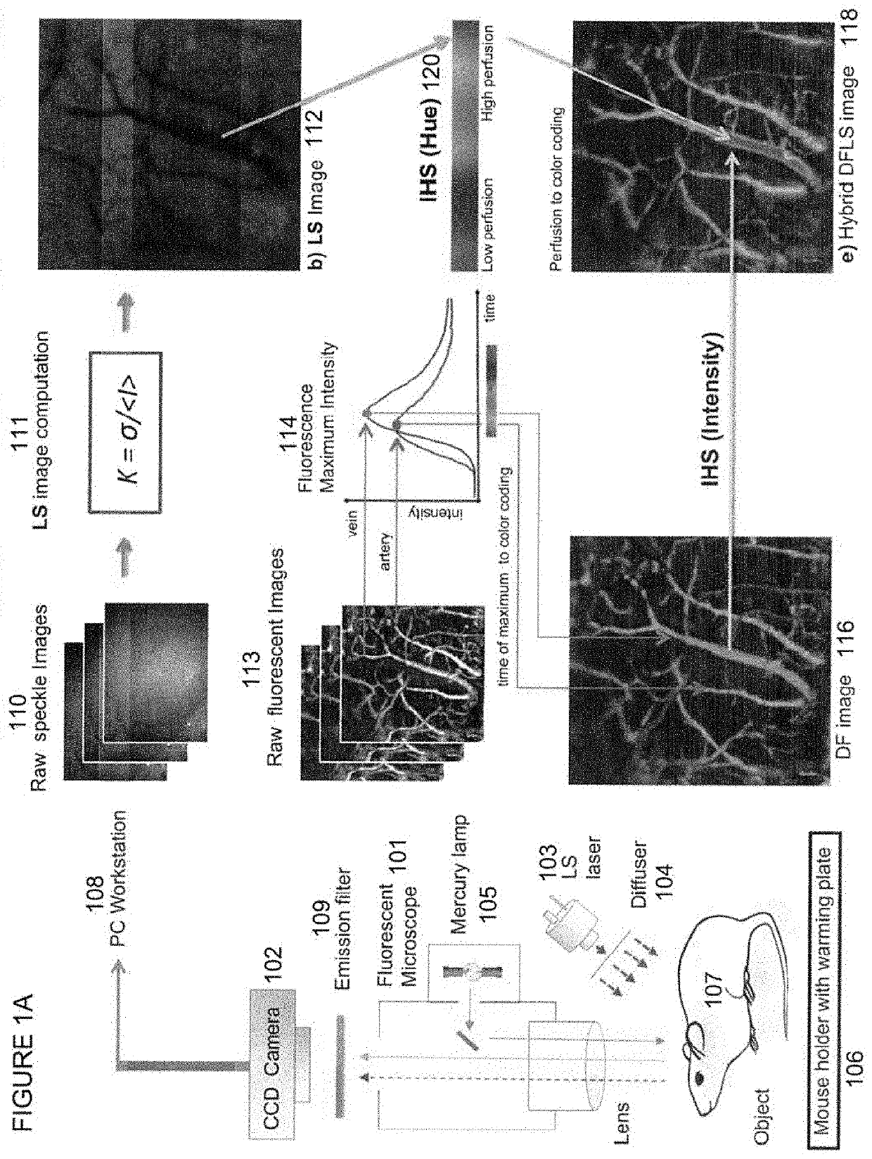 Multimodal transcranial brain optical imaging