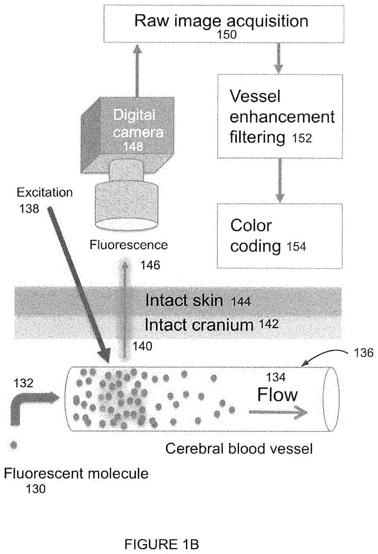 Multimodal transcranial brain optical imaging