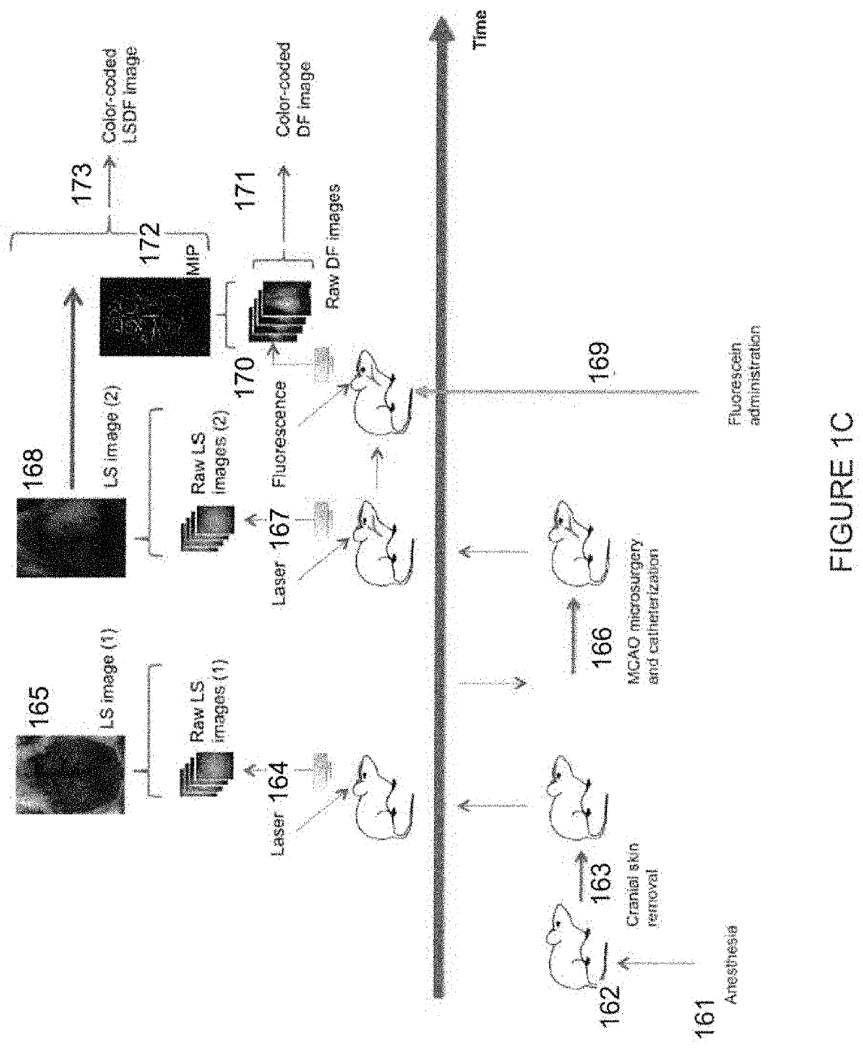 Multimodal transcranial brain optical imaging