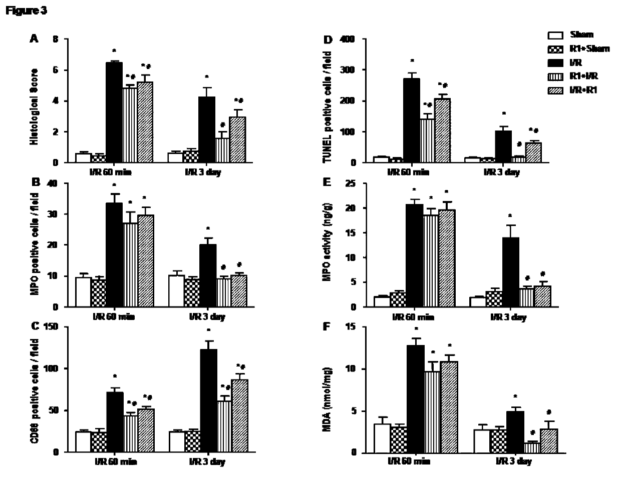 Protective effect of notoginsenoside R1 on small intestine ischemia/reperfusion injury
