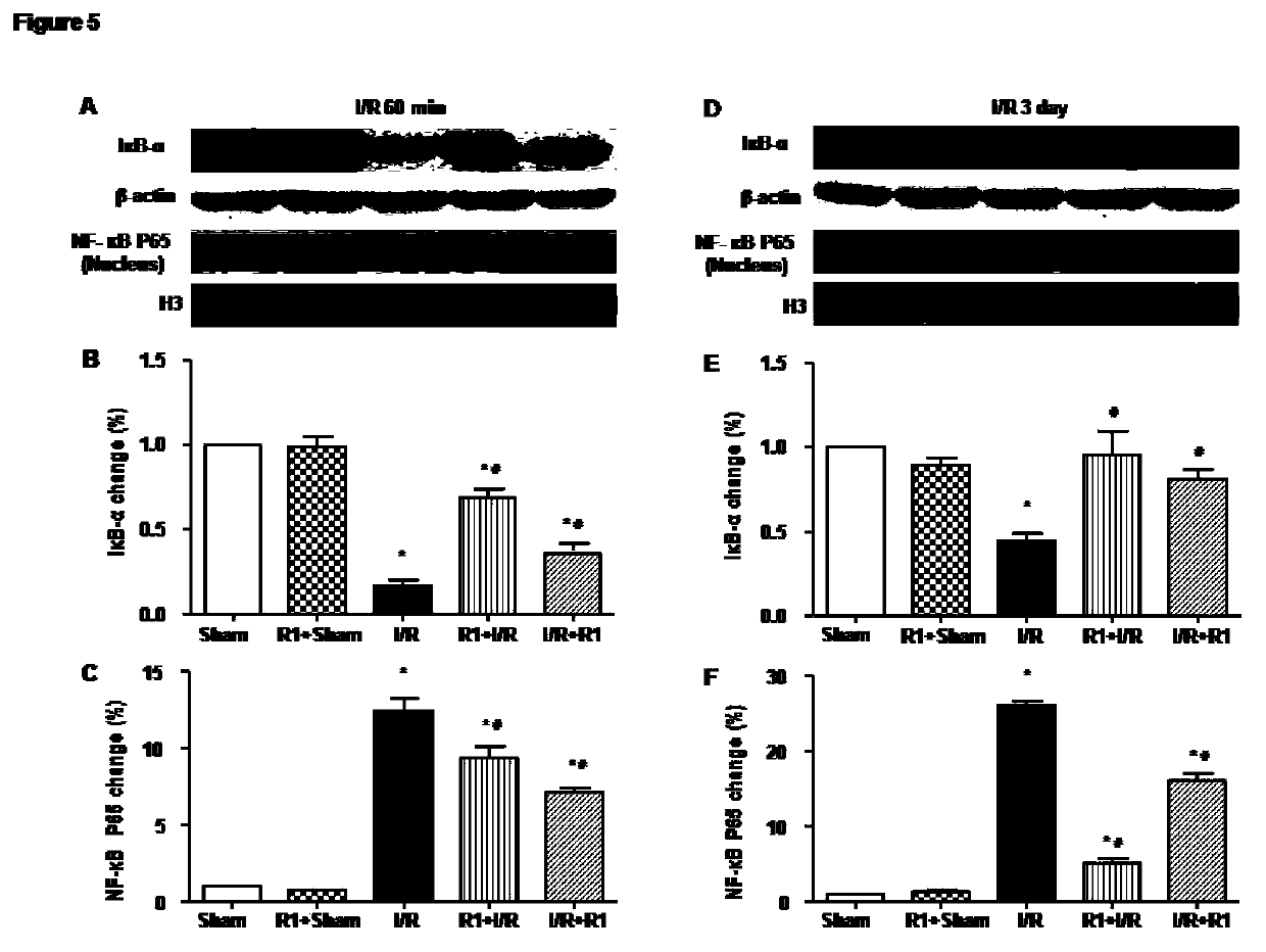 Protective effect of notoginsenoside R1 on small intestine ischemia/reperfusion injury
