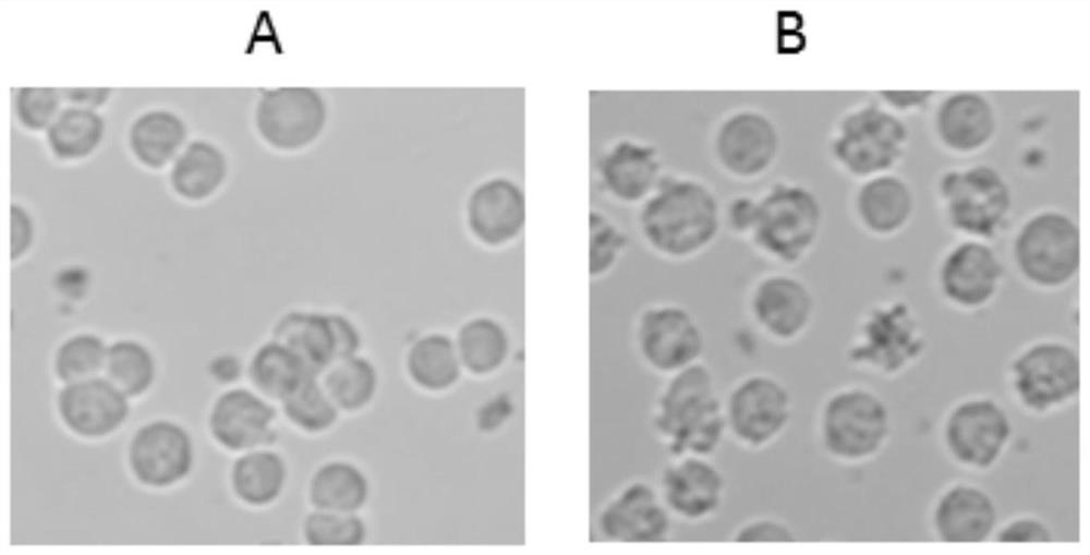 A kind of cultivation method of defective adenovirus adc68-gp