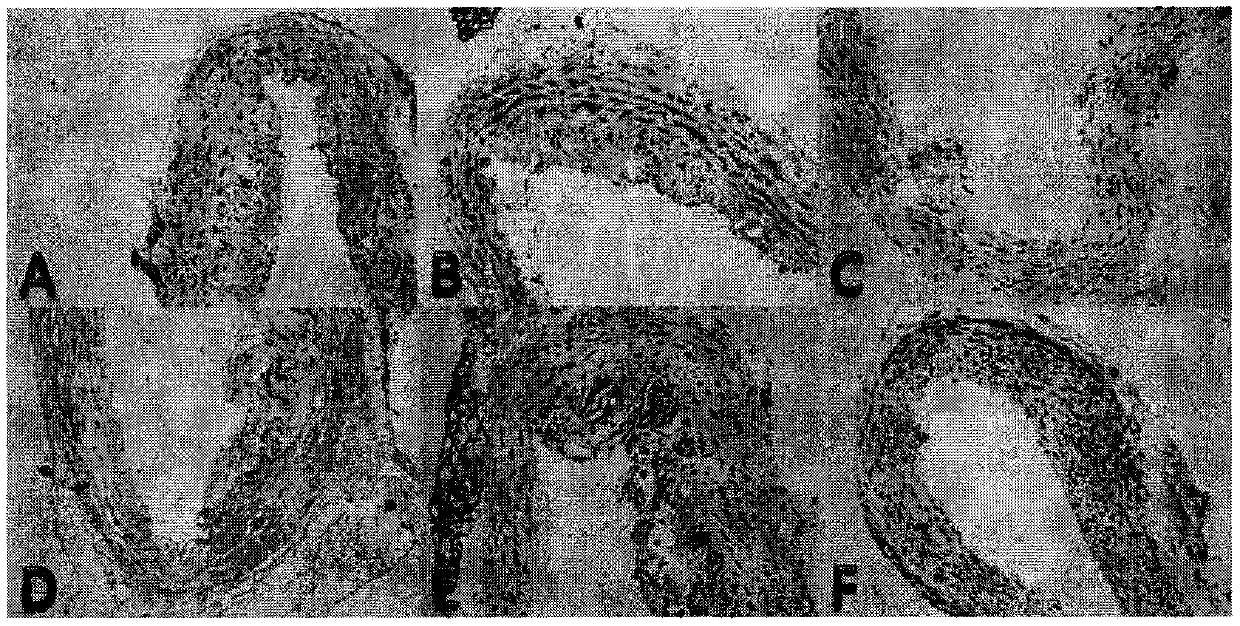 Traditional Chinese medicine composition, medicine containing traditional Chinese medicine composition, preparation method and application thereof