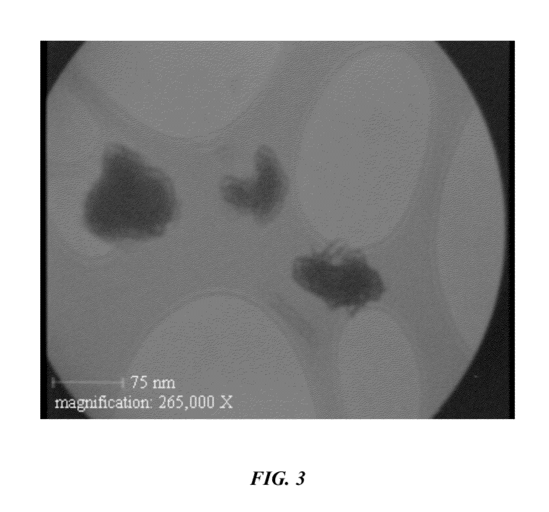 Dental cement composition