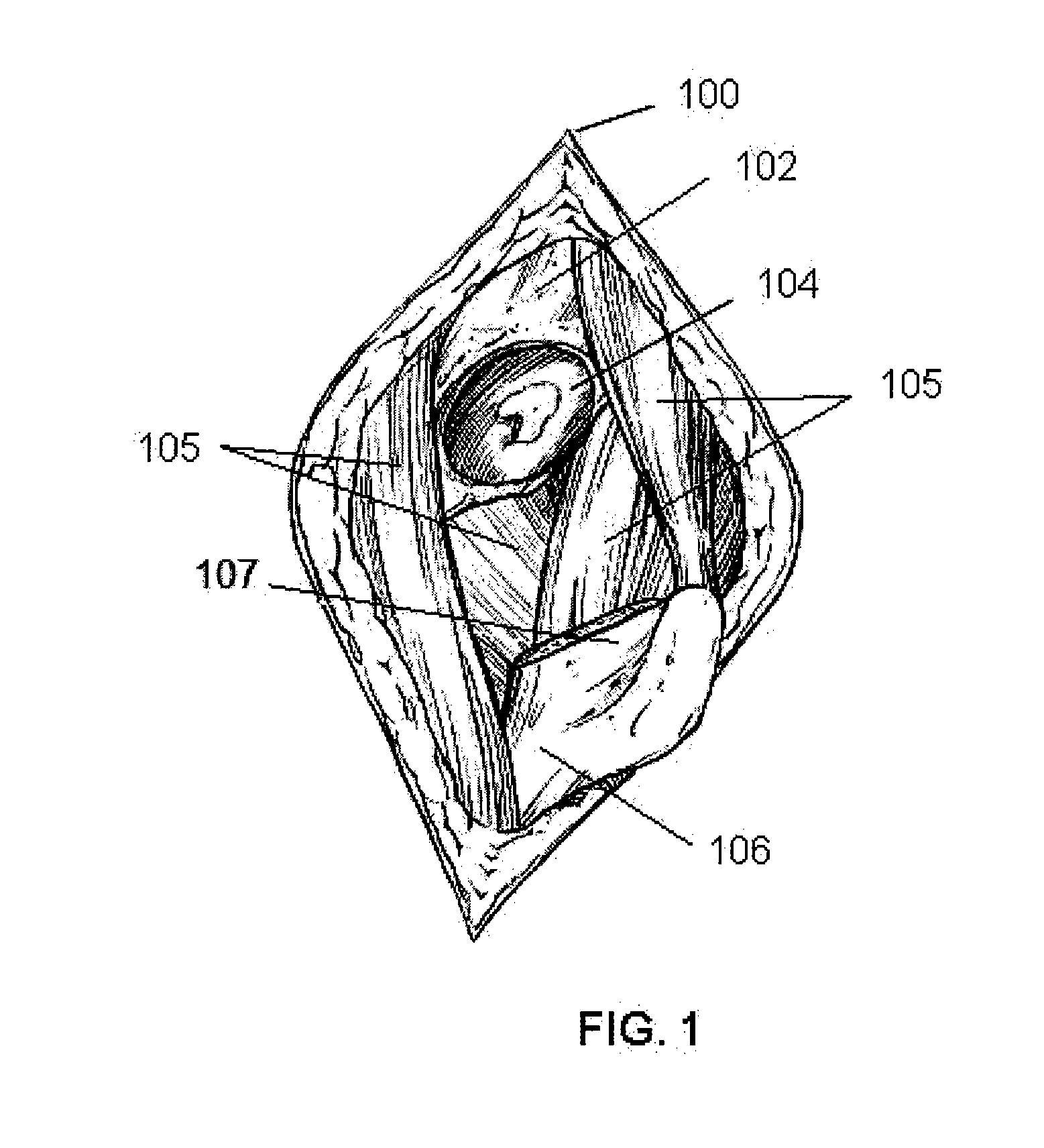 Apparatus and method for sculpting the surface of a joint