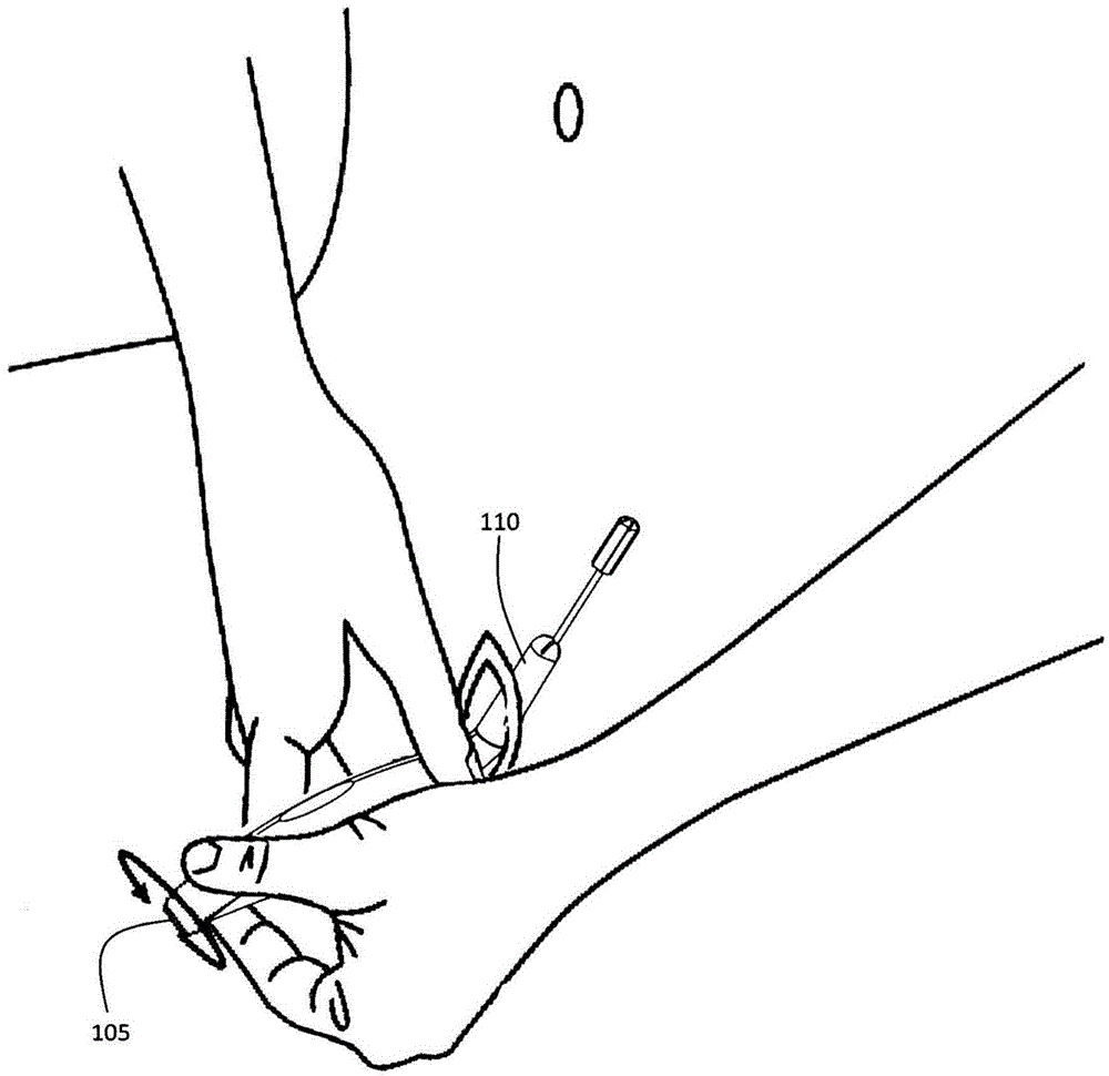 Specimen collection device and kit