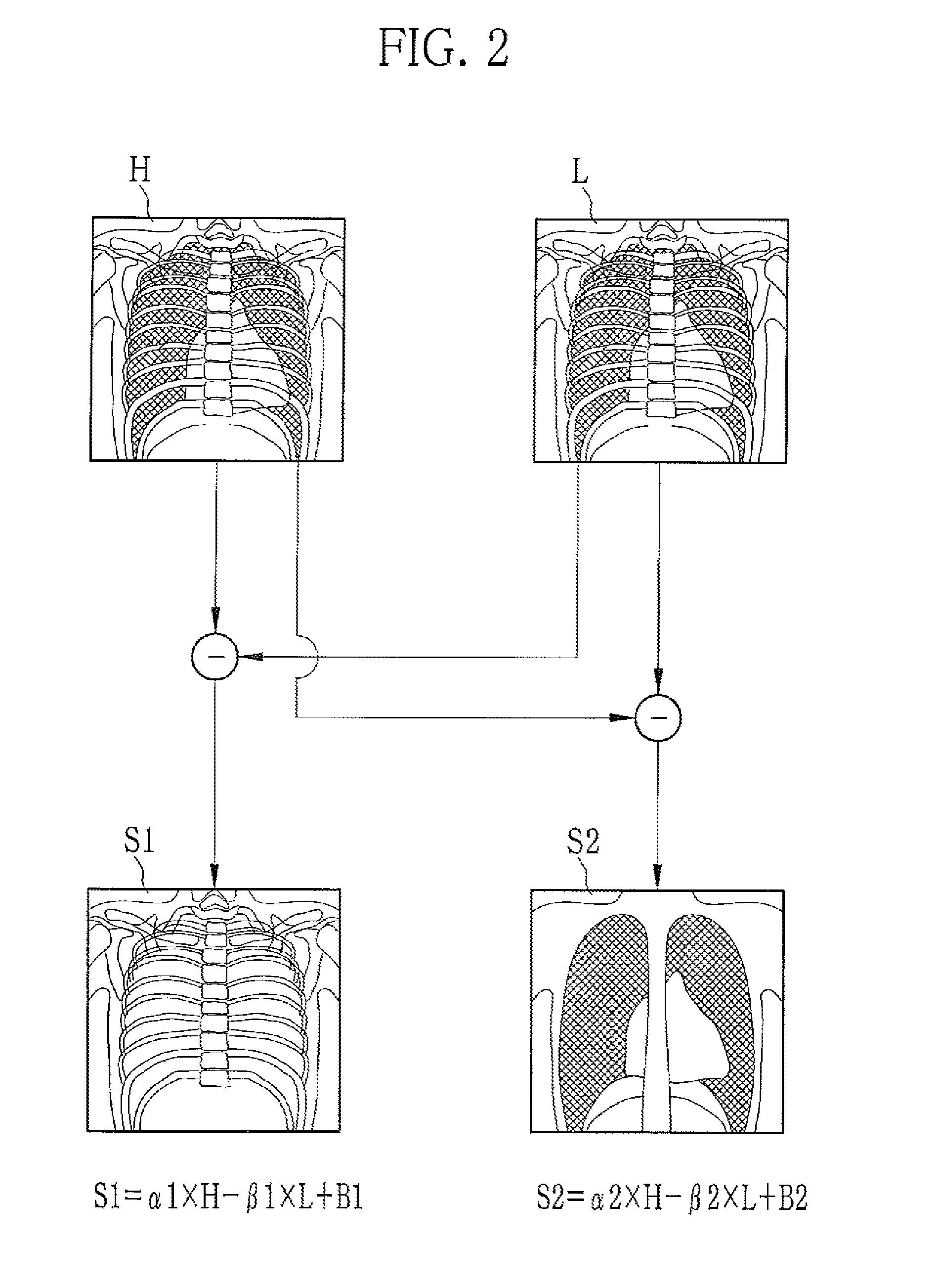 Radiation imaging apparatus and imaging control device controlling a filter based on subject information