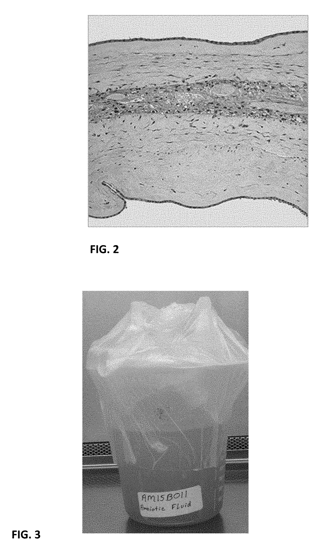 Acellular biologic composition and method of manufacture