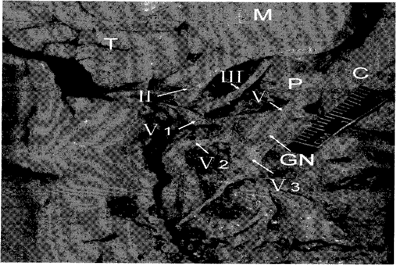 Human embryonic trigeminus based three-dimensional reconstruction method by using slide stainer