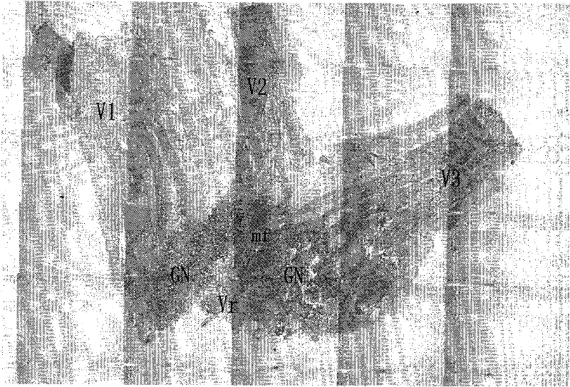 Human embryonic trigeminus based three-dimensional reconstruction method by using slide stainer