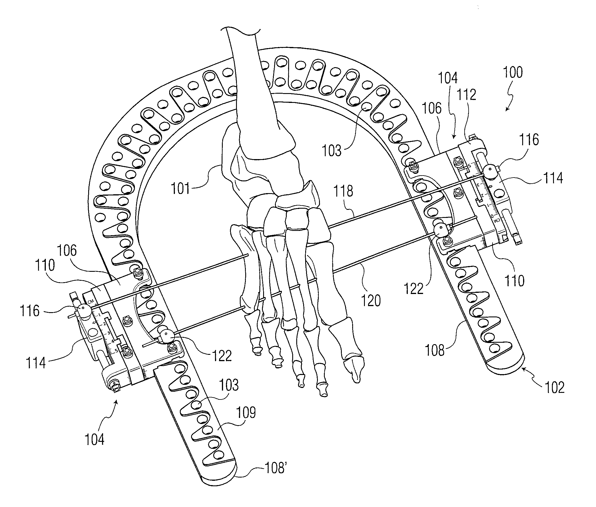 Dynamic external fixator and methods for use