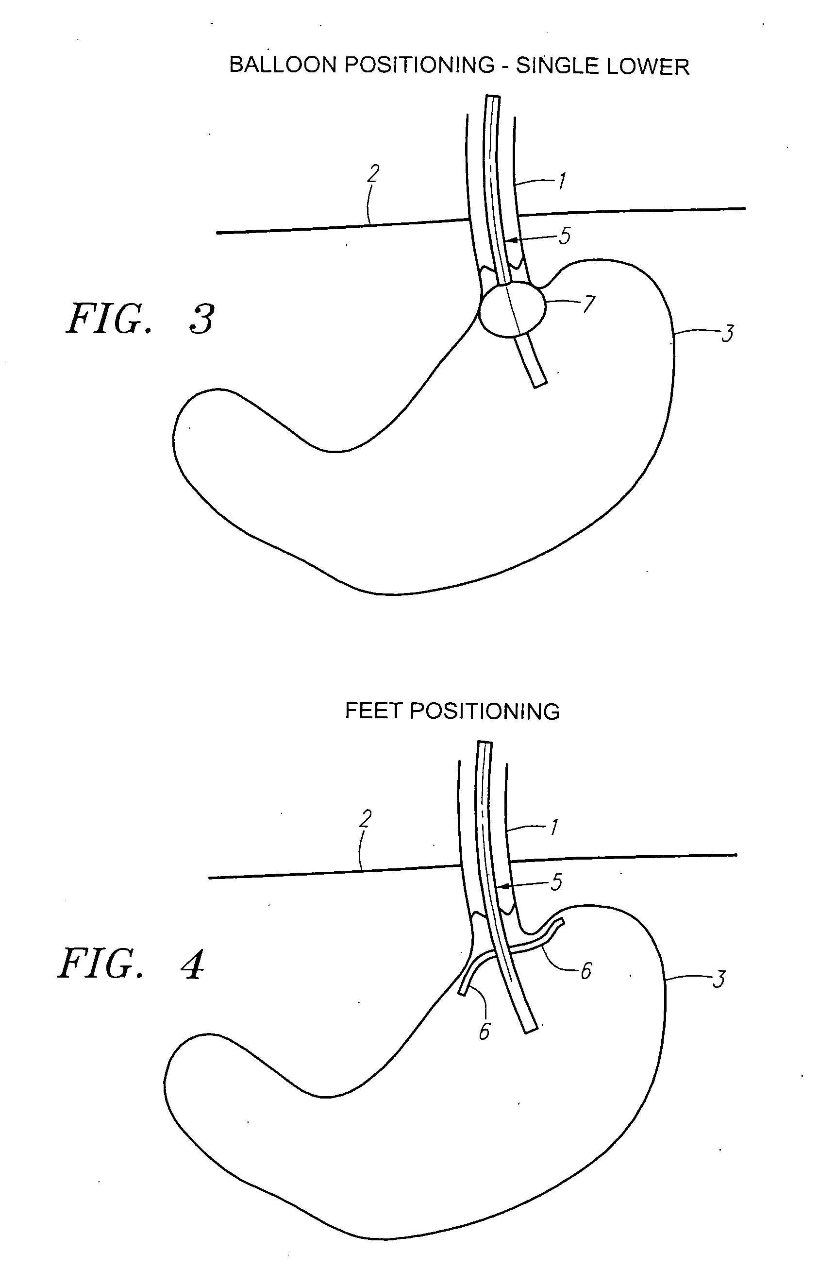 Methods and apparatus for testing disruption of a vagal nerve