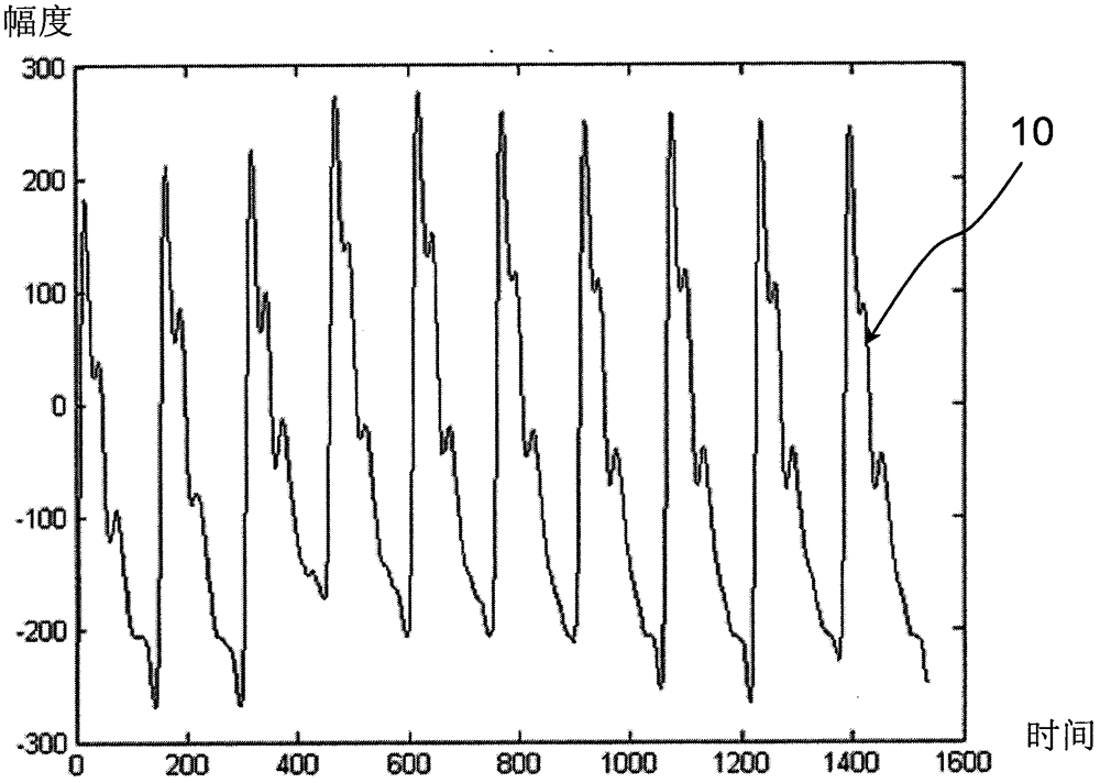 Extraction of Characteristic Parameters of Pulse Wave