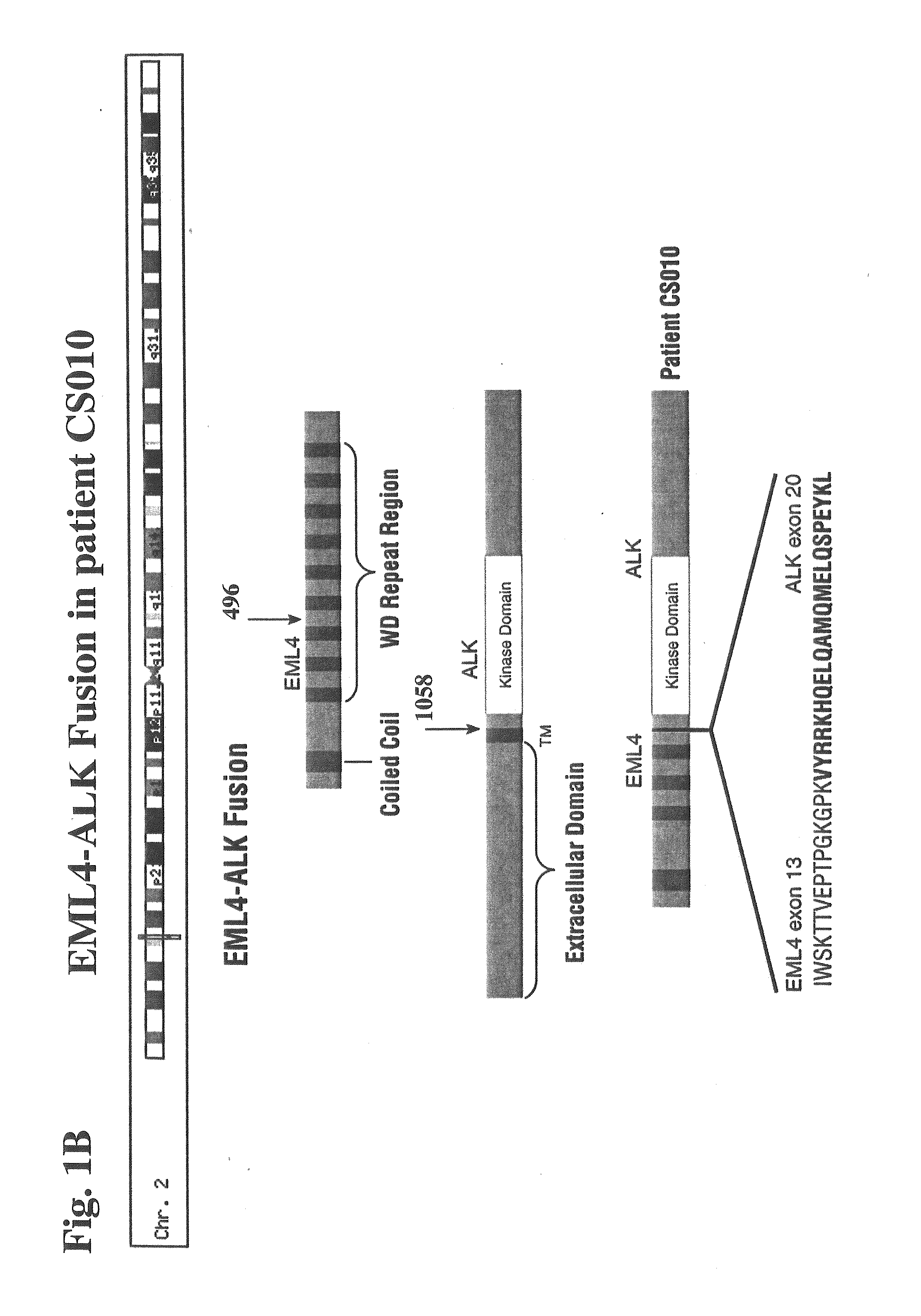 Gene Defects and Mutant ALK Kinase in Human Solid Tumors