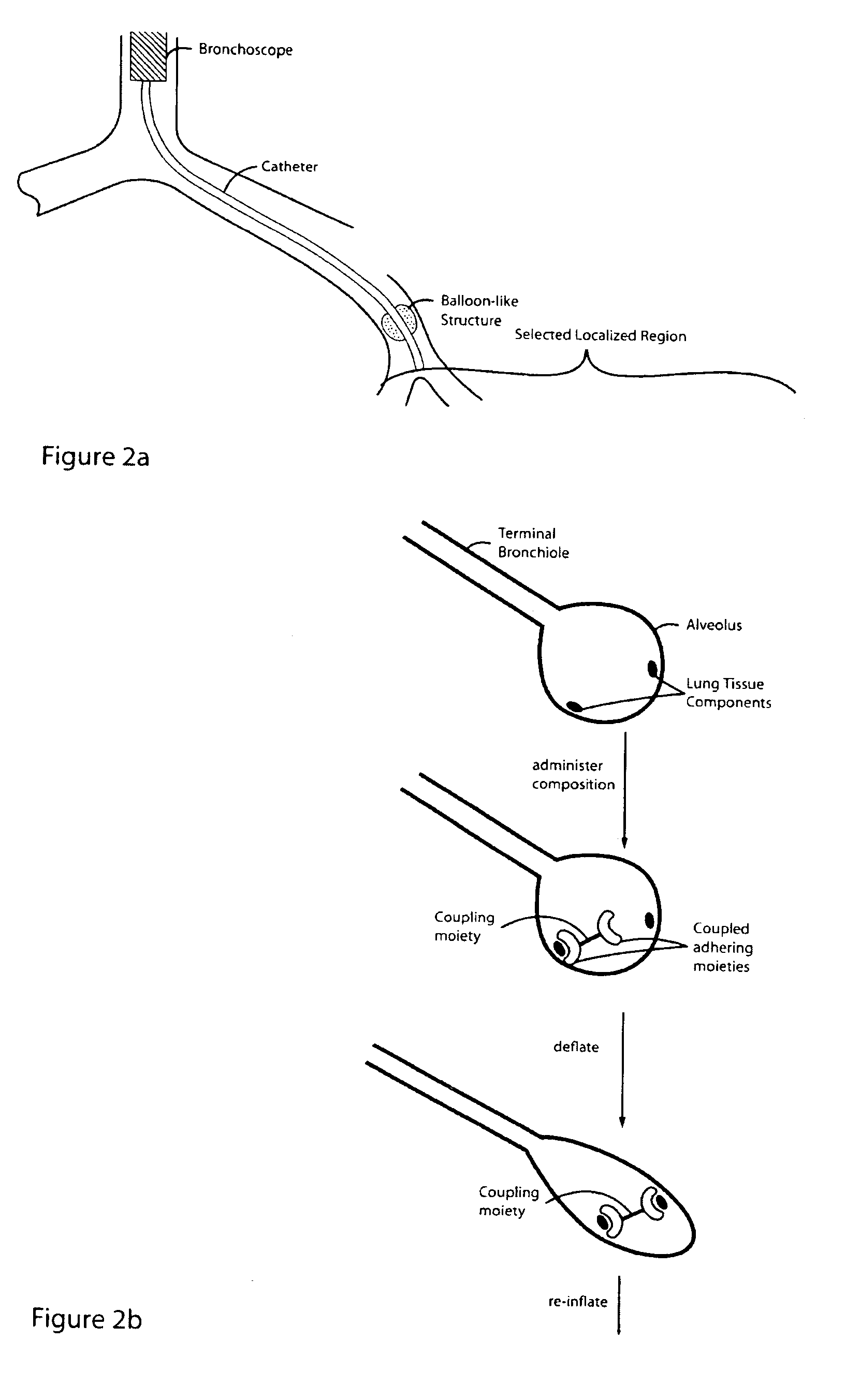 Lung volume reduction using glue compositions