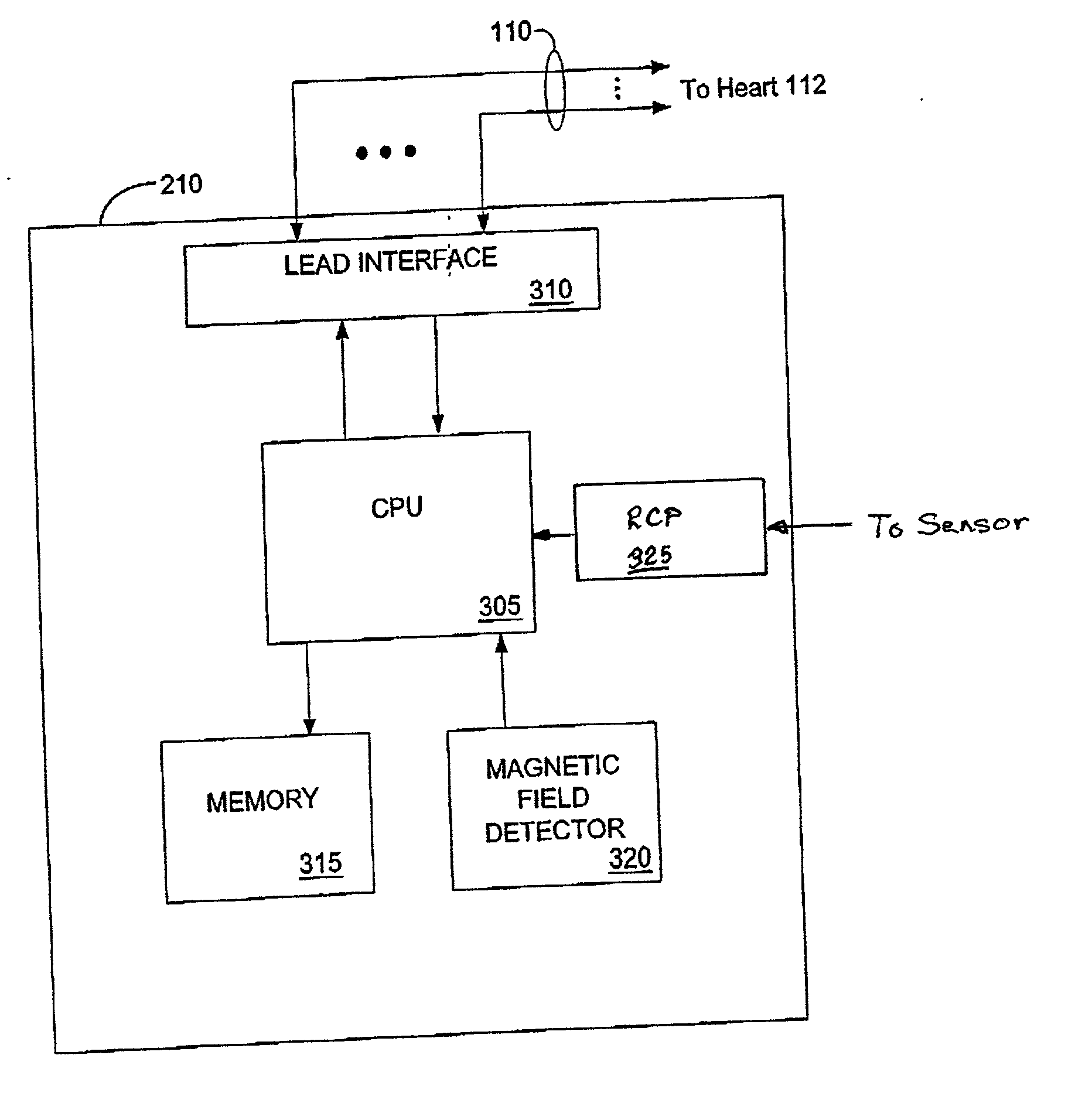 Methods and apparatus for controlling a pacing system in the presence of EMI
