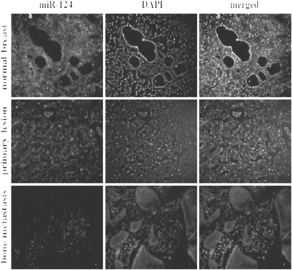 Application of miR-124 in mammary cancer bone metastasis diseases