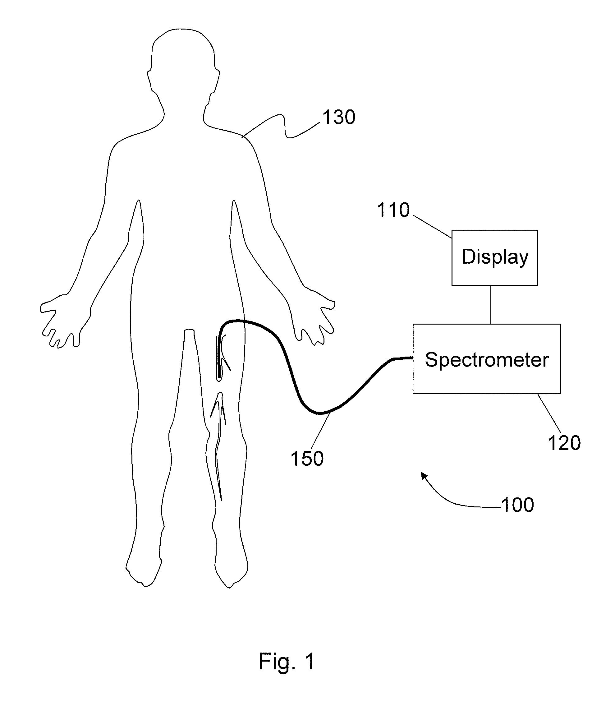 Systems and methods for analysis and treatment of an occluded body lumen
