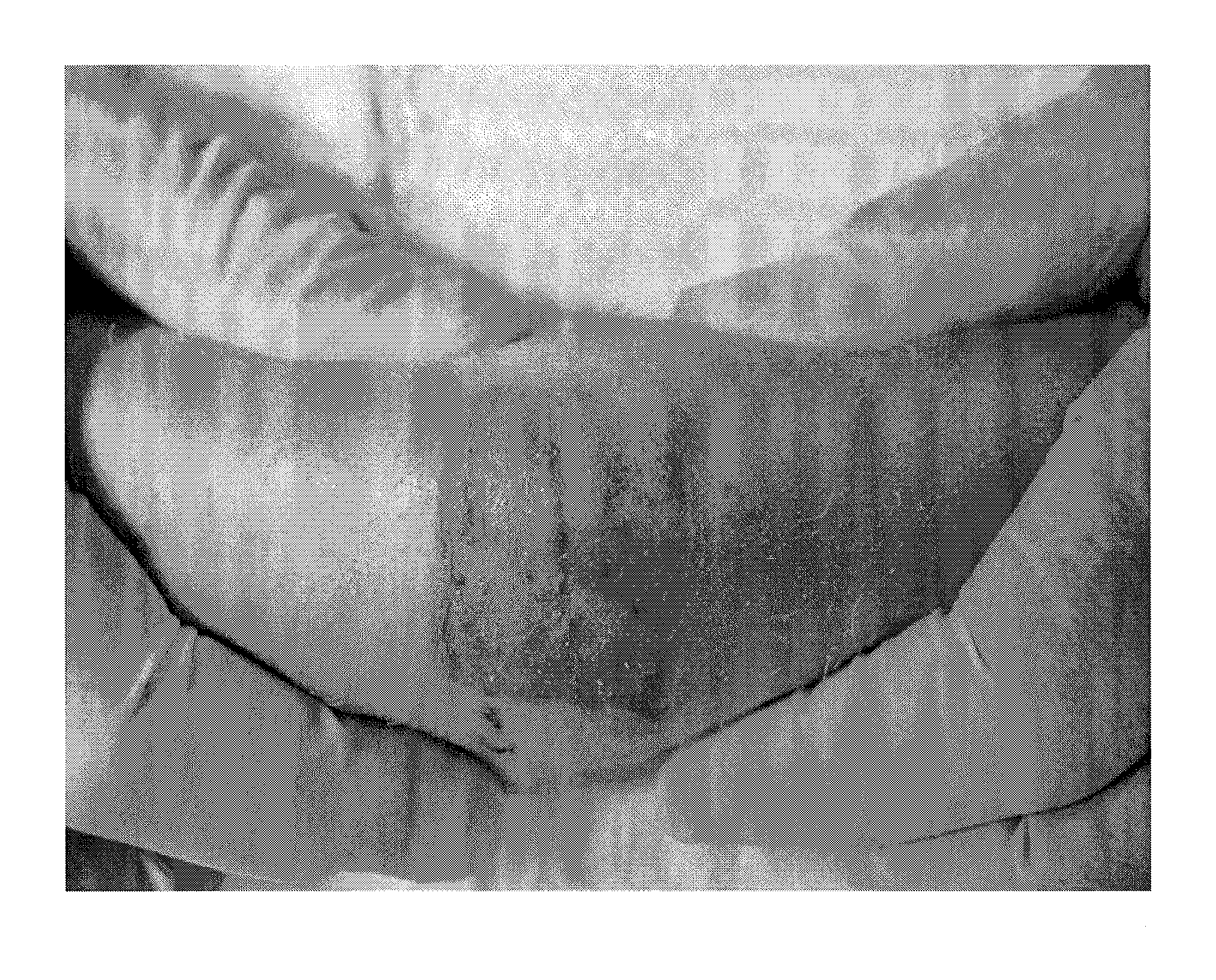Method for using hydrogel sheet for treating wound
