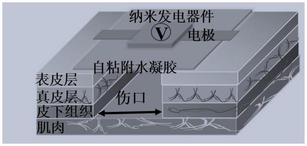 Self-adhesive hydrogel patch with self-generating performance as well as preparation method and application of self-adhesive hydrogel patch