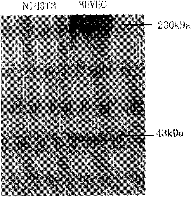 VEGFR-2 resistant monoclonal antibody with human and mouse cross reaction as well as preparation method and application thereof