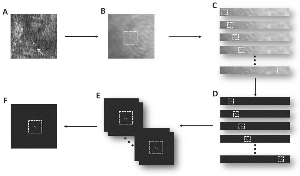 Surface plasmon imaging system based on differential denoising
