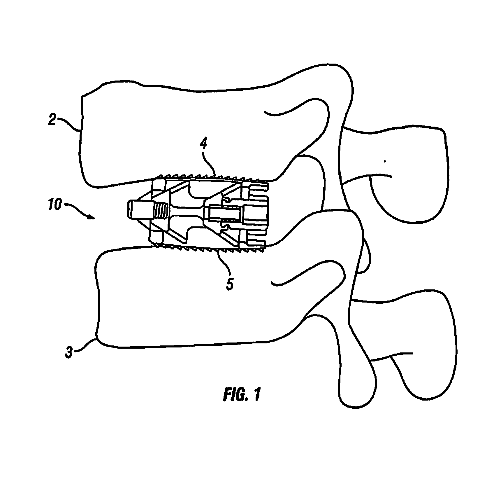 Expandable Fusion Device and Method of Installation Thereof