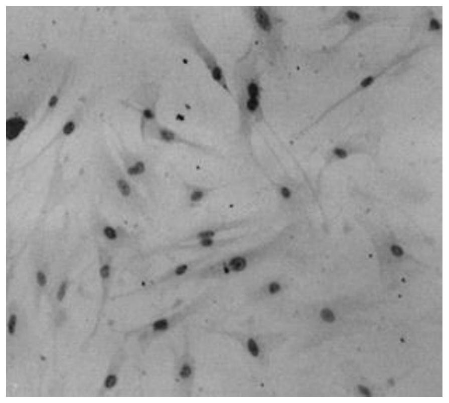 The application of nano-synthetase to promote the synthesis of high-molecular hyaluronic acid in cells