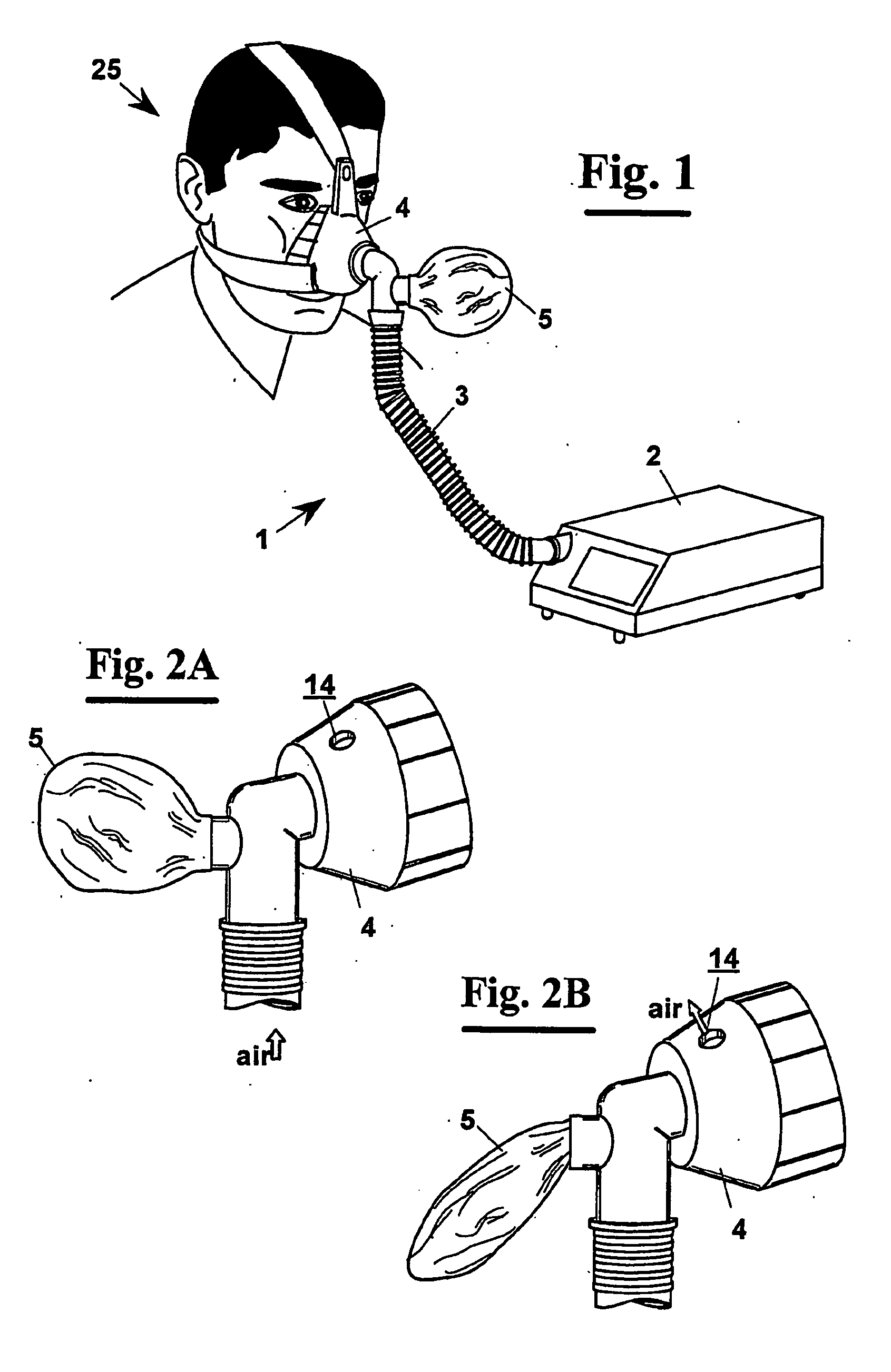 Apparatus for non-invasive mechanical ventilation