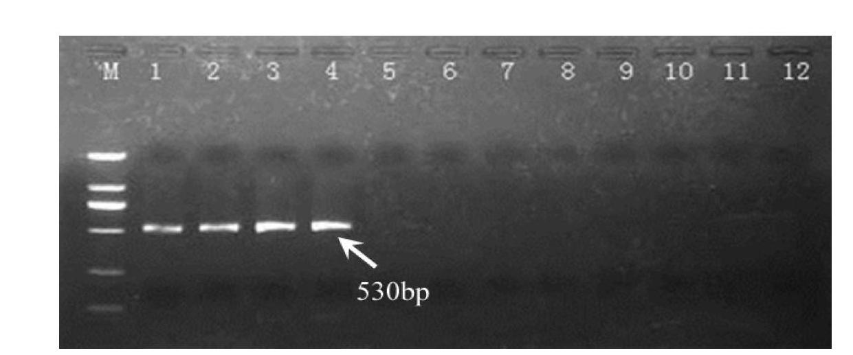 Molecular markers for identifying high temperature-resistant porphyra haitanensis strain and construction method for molecular markers
