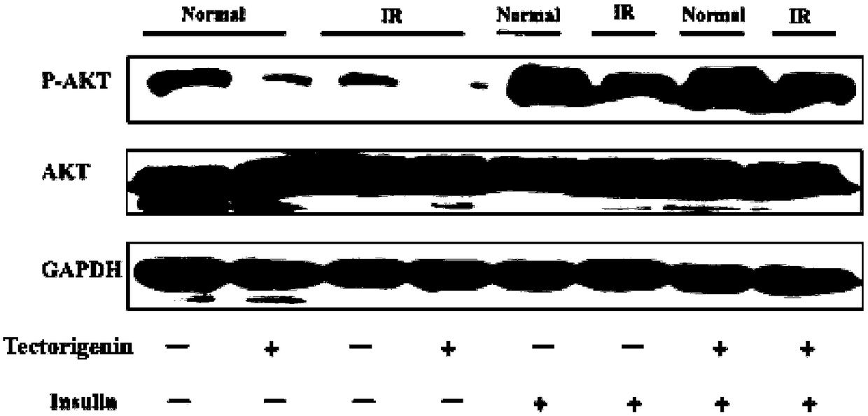 Application of tectorigenin and derivatives thereof in medicines for preventing and treating insulin resistance diseases