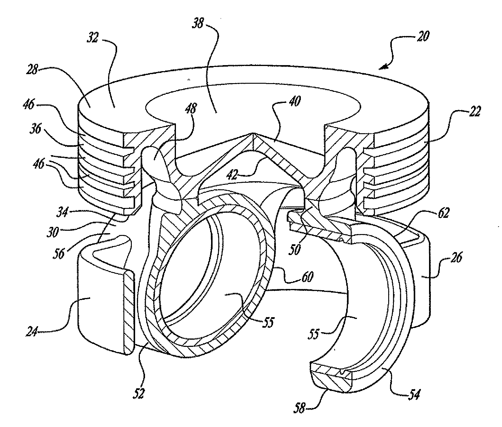 Load-optimized interior of a piston