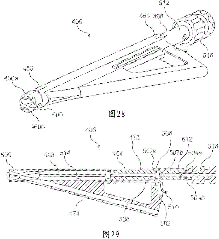 Intervertebral Interference Implants and Instruments