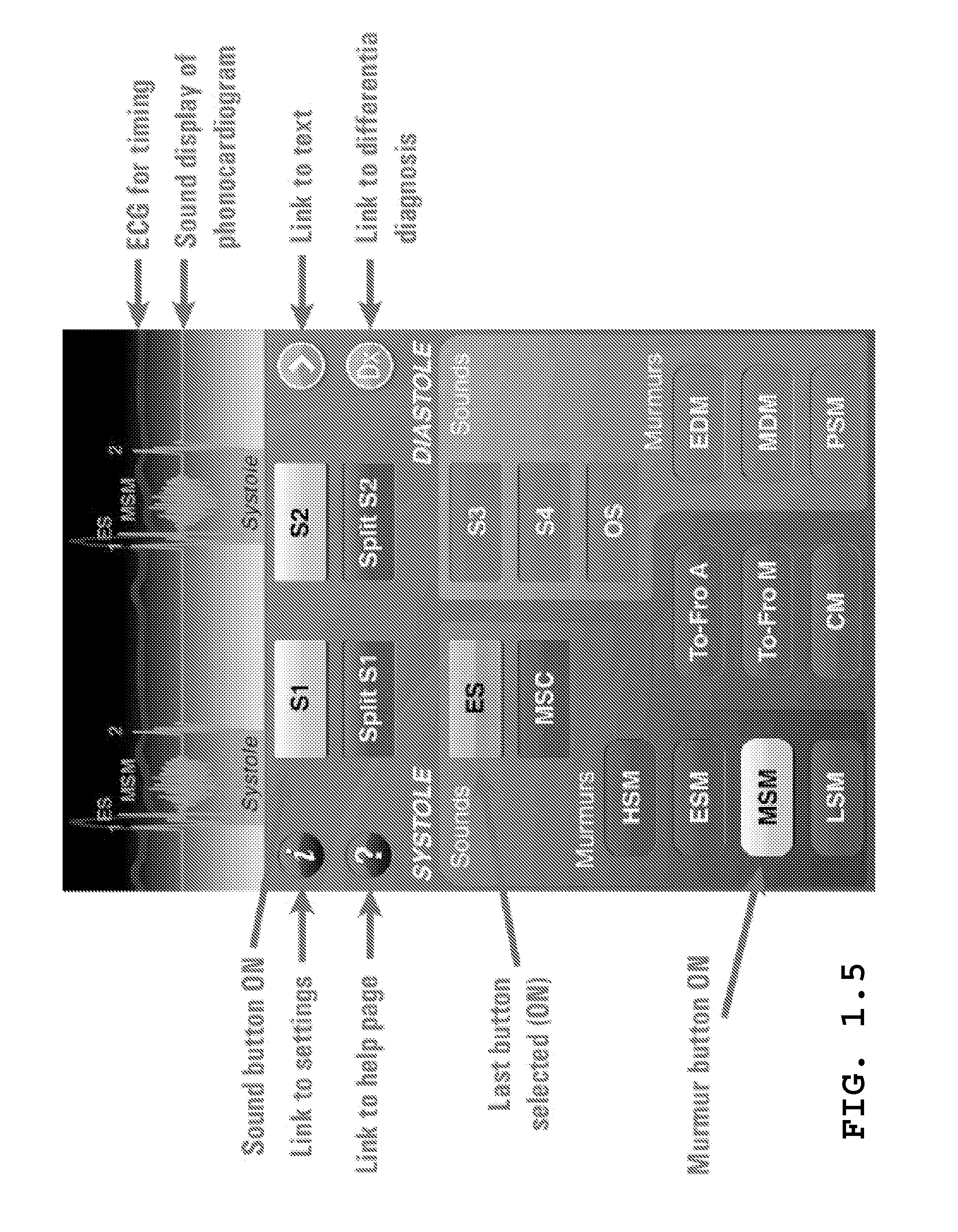Method and system for identifying cardiopulmonary findings by using a heart and lung sounds builder