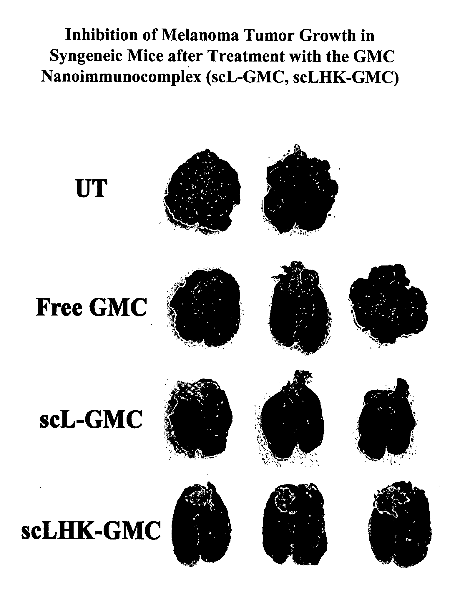 Preparation of antibody or an antibody fragment-targeted immunoliposomes for systemic administration of therapeutic or diagnostic agents and uses thereof