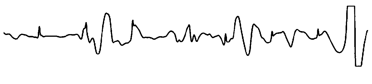 Data collection method and device, intelligent wearable equipment and storage medium