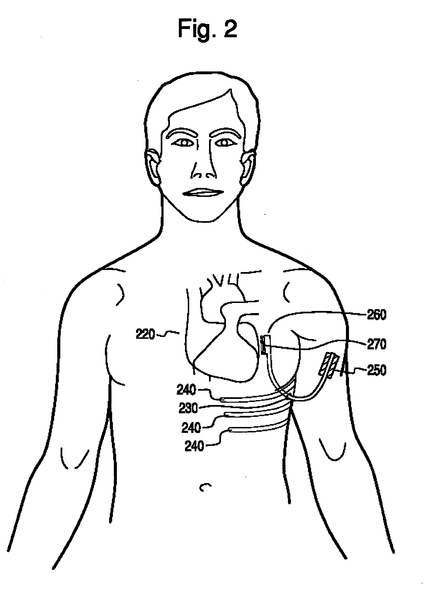 Methods and systems for ultrasound imaging of the heart from the pericardium