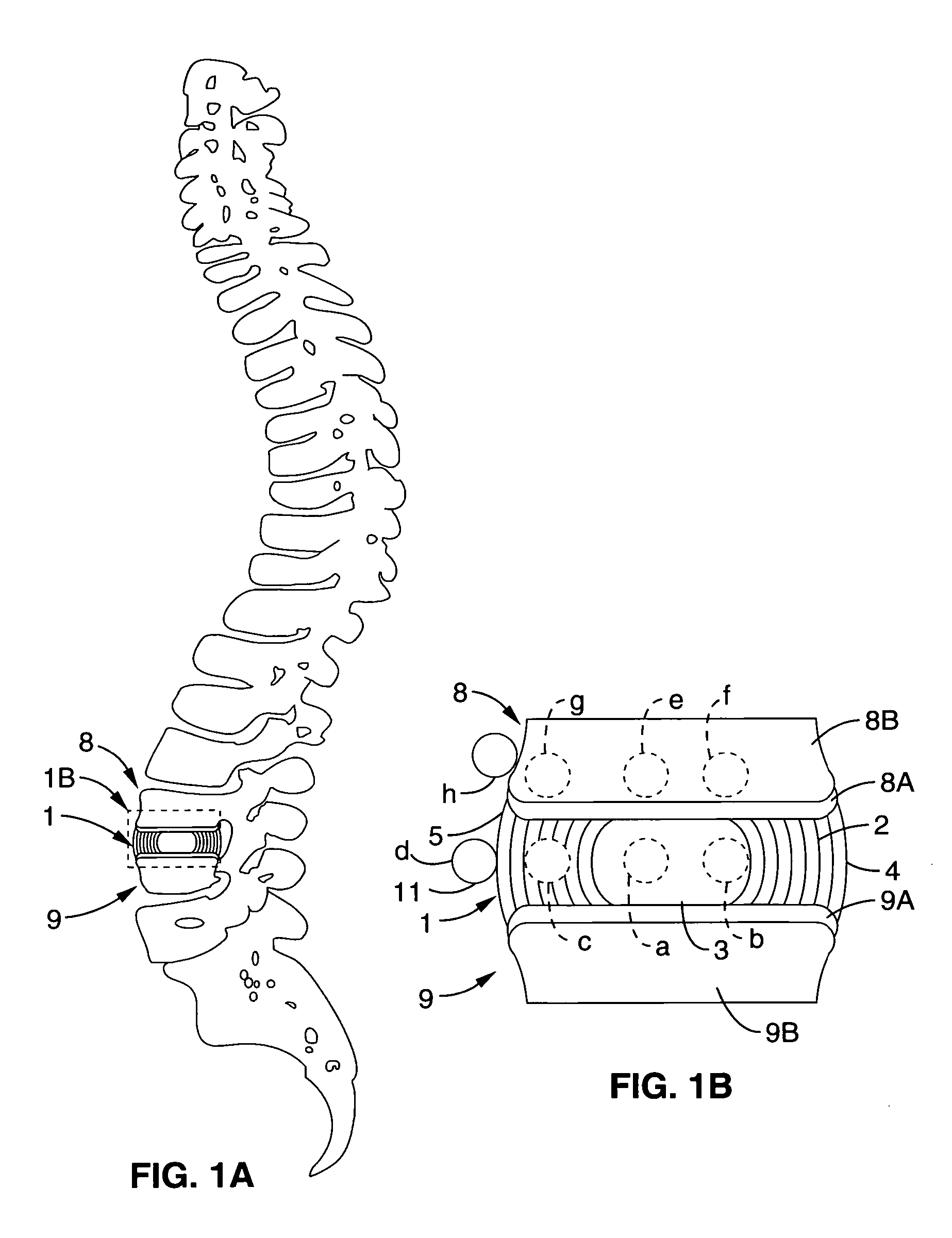 System and method providing directional ultrasound therapy to skeletal joints