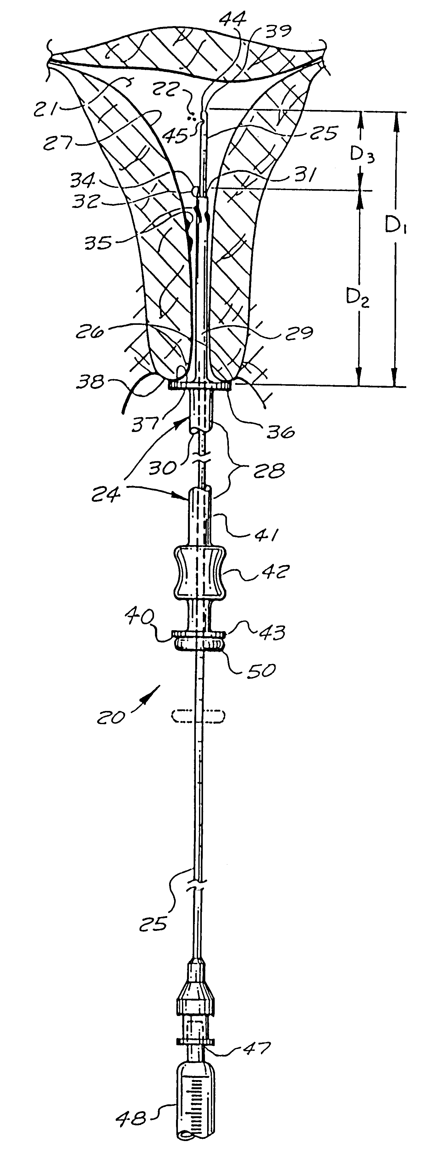 Catheter system for implanting embryos