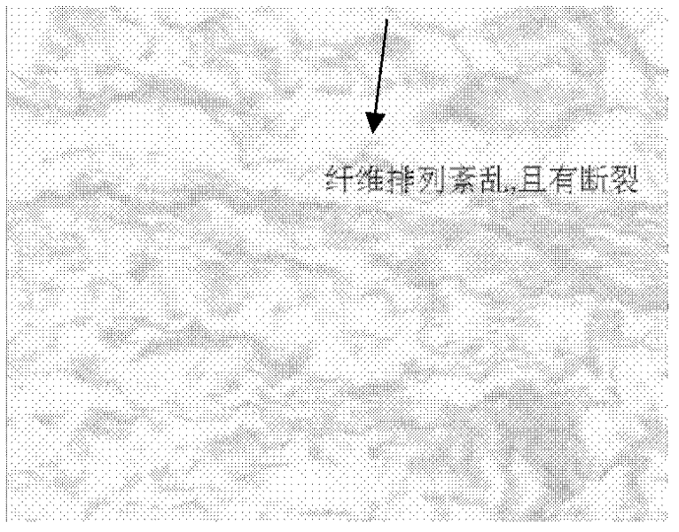 Preparation method of acellular dried active amnion