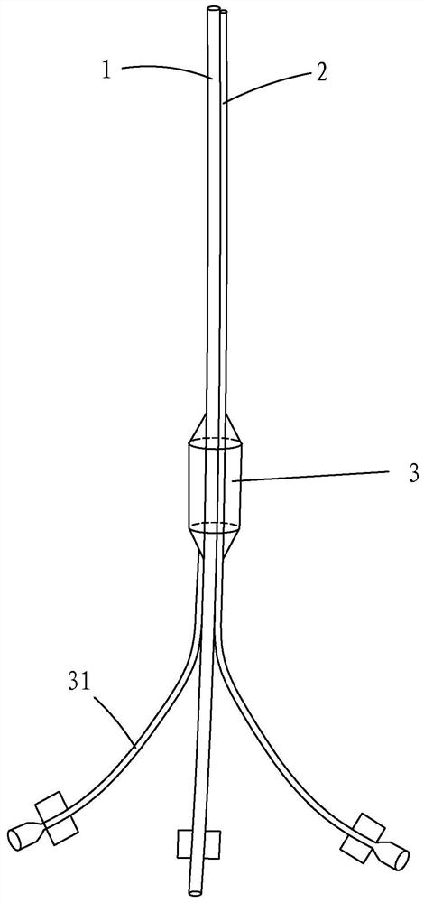 Renal pelvis pressure monitoring balloon perfusion catheter