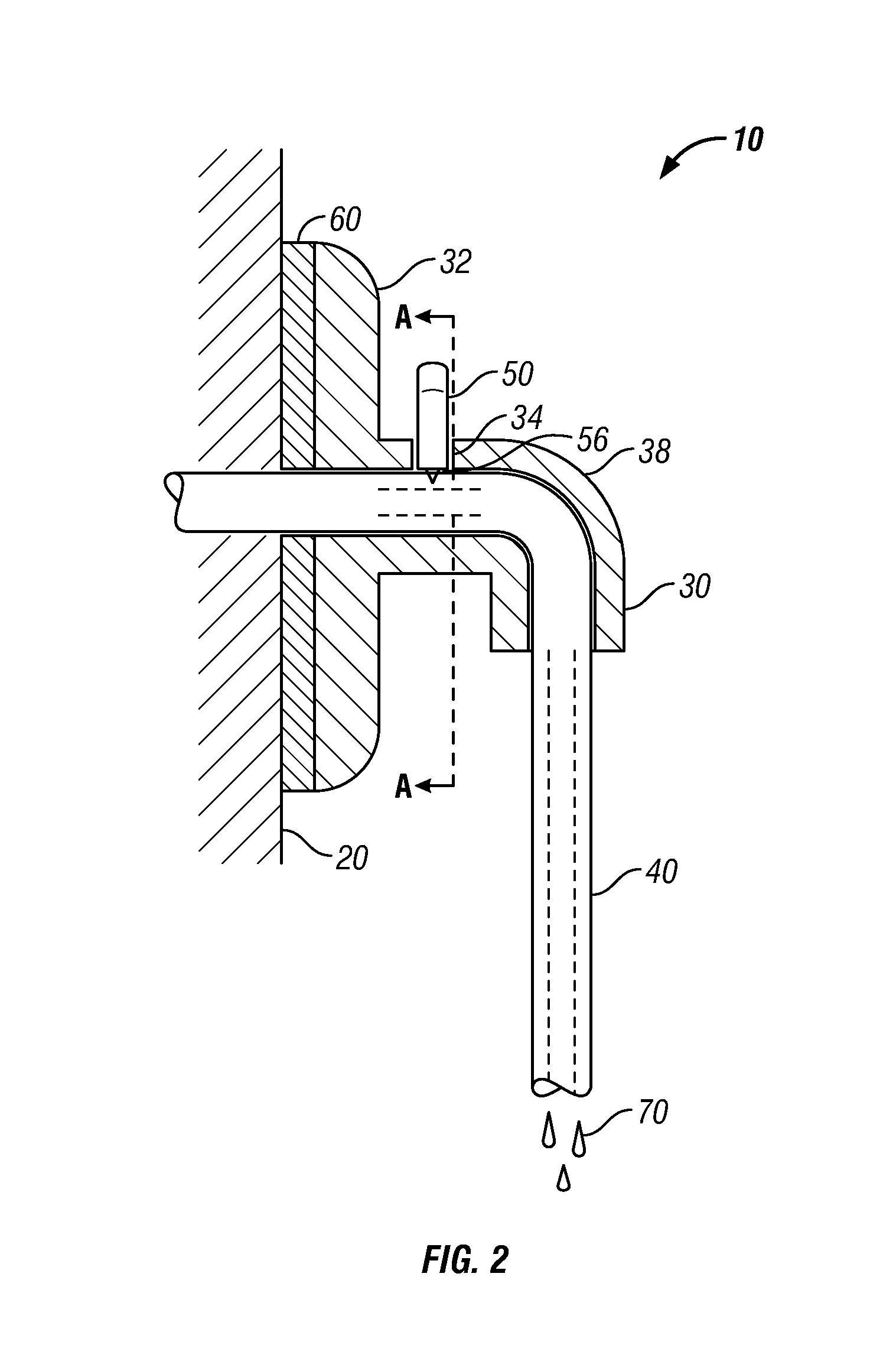 Article for securing a catheter