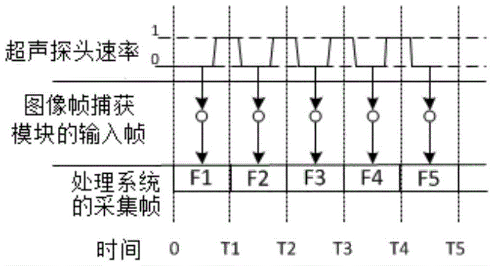 Carotid artery three-dimensional image construction device