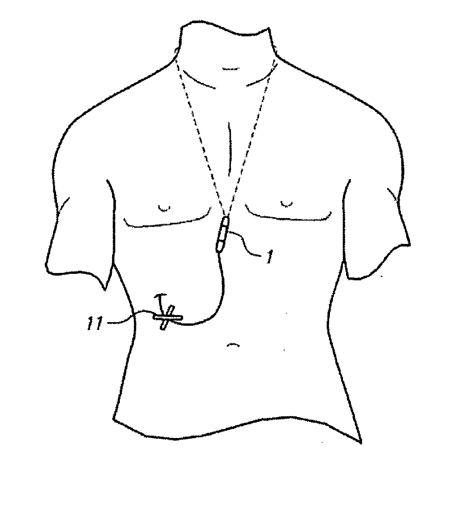 User wearable device for carrying peritoneal dialysis catheter