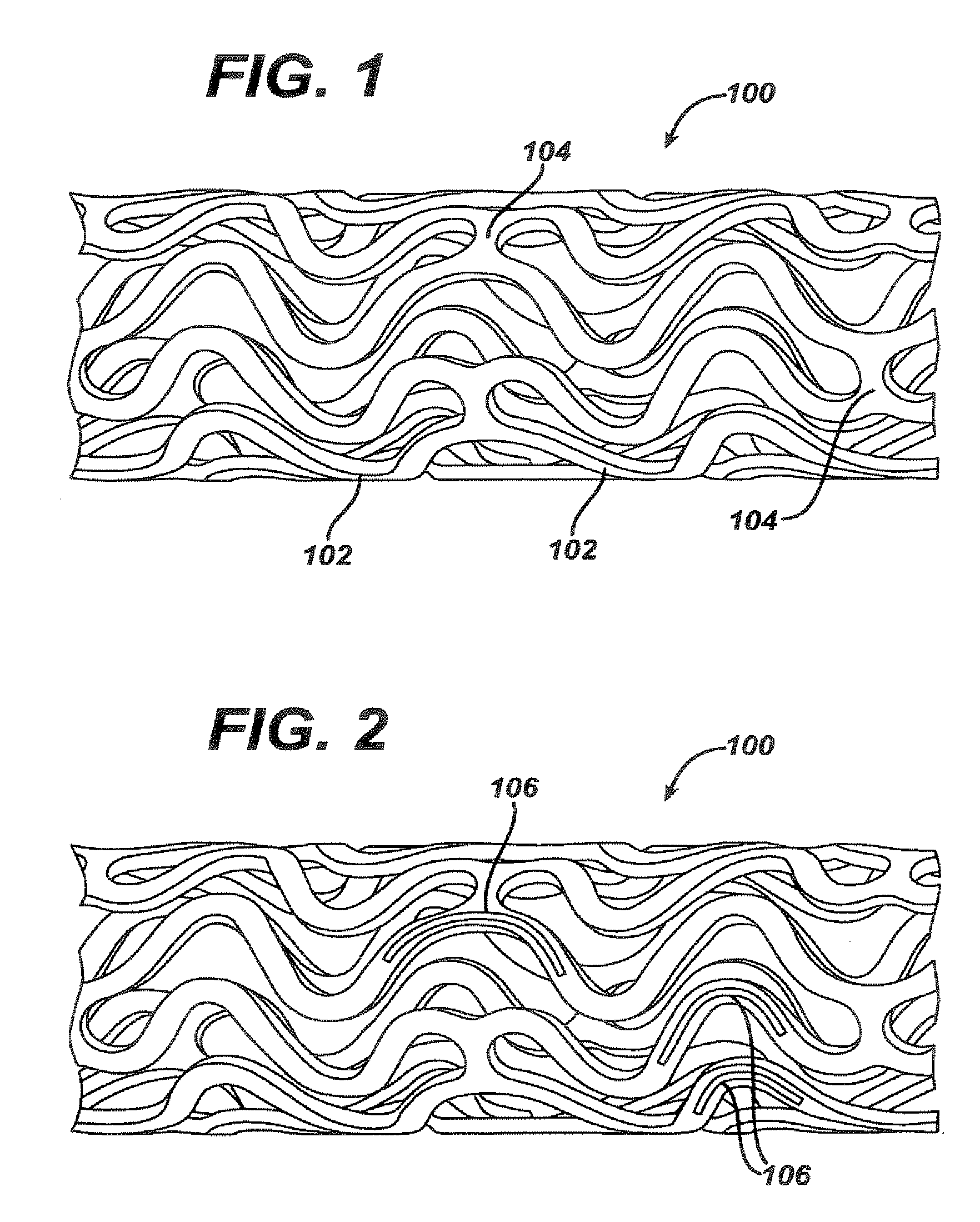 Local administration of a combination of rapamycin and panzem for the treatment of vulnerable plaque