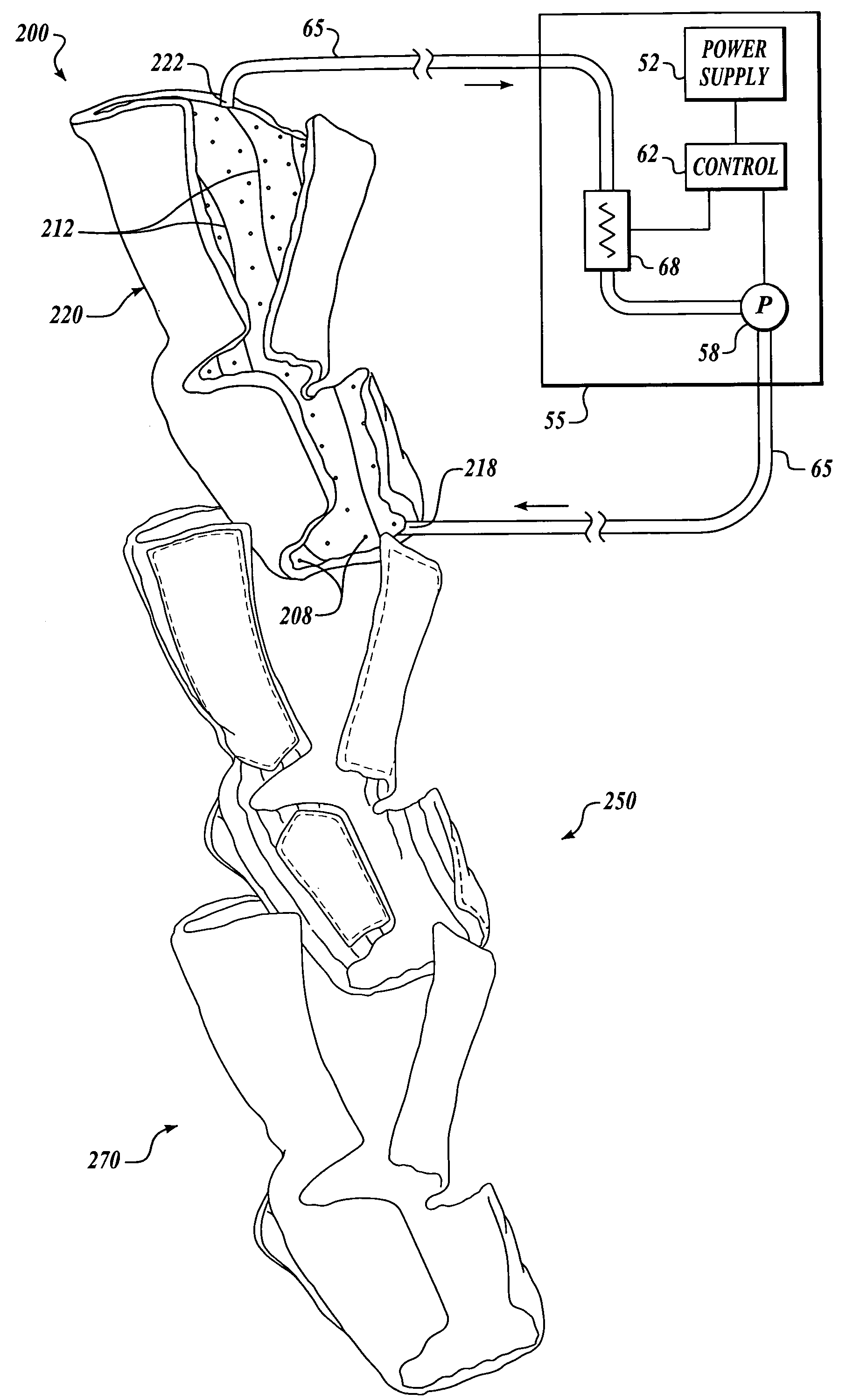 Method and device for treatment of edema